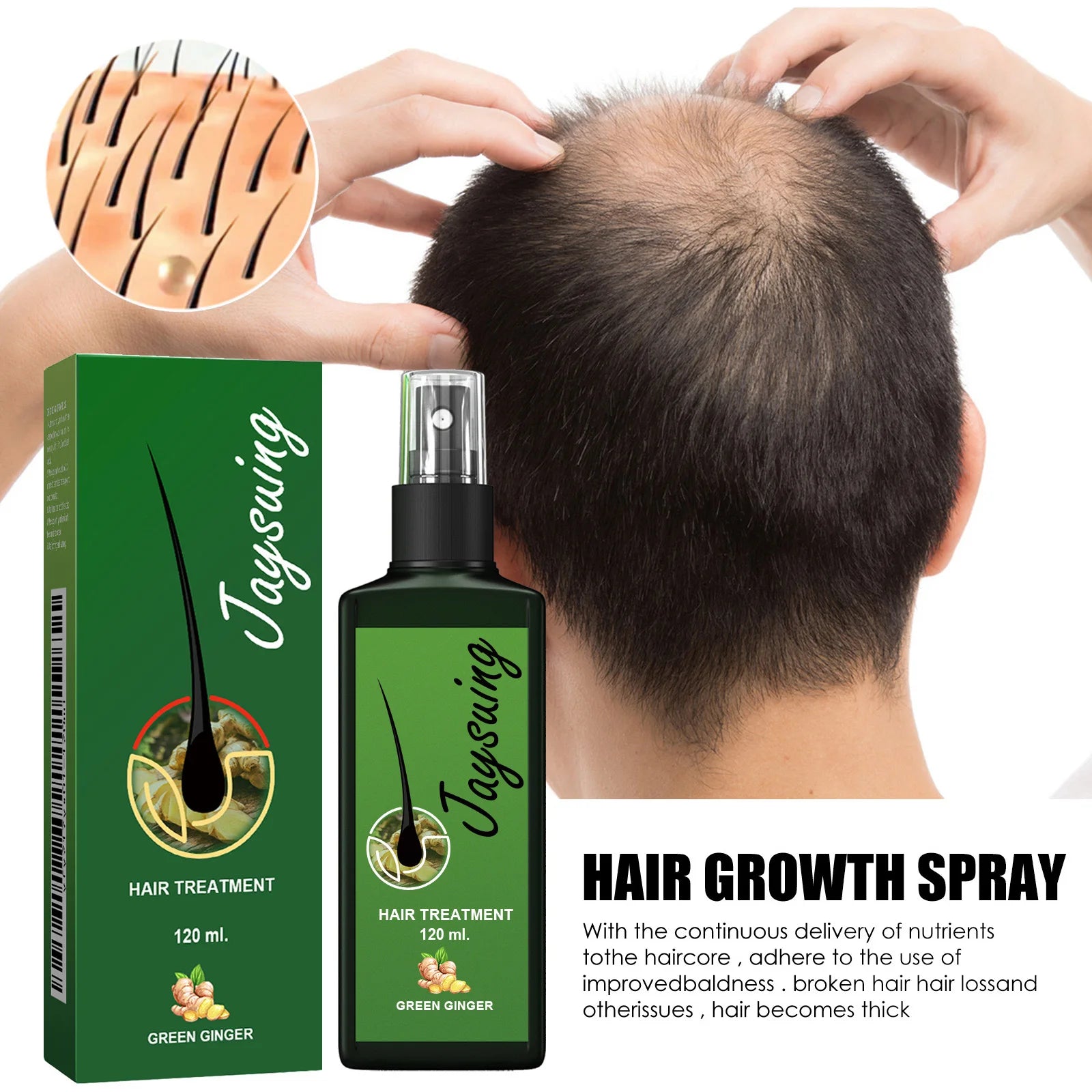 Ginger Hair Growth Serum Spray Scalp Treatment Nourish Hair Root Strengthen Prevent Loss Repair Follicle Smooth Essence Nutrient